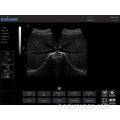 Ultrasuoni per laptop per gatto Ragdoll incinta